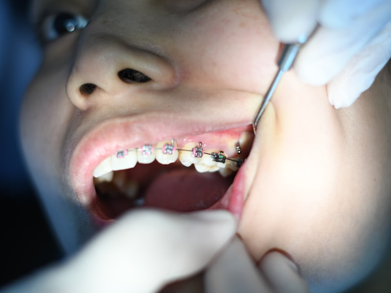 Metal braces during orthodontic treatment